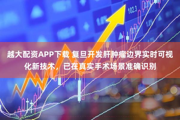 越大配资APP下载 复旦开发肝肿瘤边界实时可视化新技术，已在真实手术场景准确识别